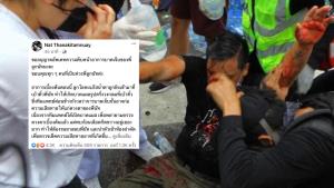 “ไฮโซลูกนัท” ถูกยิงเบ้าคิ้ว ฝากข้อความถึงมวลชน “ไม่ต้องห่วง ขอให้ยึดมั่นต่อสู้แบบสันติ”