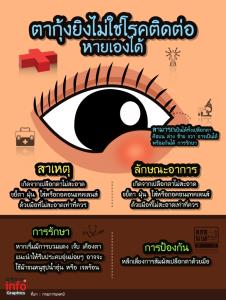 ตากุ้งยิงไม่ใช่โรคติดต่อ หายเองได้