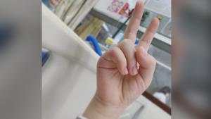 แม่แชร์ประสบการณ์! ลูกป่วย “MIS-C” ภาวะอักเสบทั่วร่างกาย เกิดขึ้นในเด็กหลังติดเชื้อโควิด
