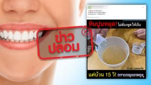 ข่าวปลอม! Motto mouthwash สามารถขจัดหินปูนในช่องปากได้ภายใน 15 วินาที
