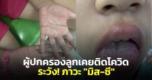 หมอแนะผู้ปกครอง ลูกเคยติดเชื้อโควิด ควรศึกษาภาวะ "มิส-ซี" อาการอักเสบของอวัยวะหลายระบบ
