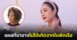 "หมอพรทิพย์" เผยอีกมุม ปมแผลที่ขา “แตงโม” อาจไม่ได้เกิดจากใบพัด