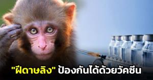 "หมอยง" เผย "ฝีดาษลิง" ป้องกันได้ด้วยวัคซีน อาการแทรกซ้อนน้อยกว่าการปลูกฝี