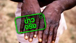 ข่าวจริง! ไทยเพิ่มโรคฝีดาษลิง เป็นโรคติดต่อเฝ้าระวังลำดับที่ 56
