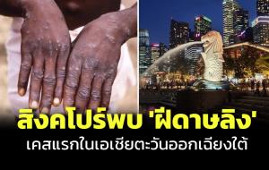 สิงคโปร์พบผู้ติดเชื้อ ‘ฝีดาษลิง’ รายแรกในเอเชียตะวันออกเฉียงใต้