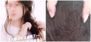 กลัวหัวล้าน! หญิงจีนงดสระ งดหวีผมนาน 3 เดือน ผลลัพธ์ทำเอาเศร้า