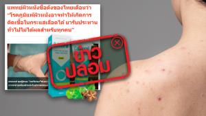ข่าวปลอม! หมอแนะนำ คาลเมรอล แฮนด์ แอนด์ ฟุต ครีม รักษาโรคผิวหนัง ภูมิแพ้