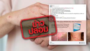 ข่าวปลอม! ผลิตภัณฑ์เสริมอาหาร Elsie รักษาโรคสะเก็ดเงิน