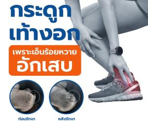กระดูกเท้างอกเหตุเพราะเอ็นร้อยหวายอักเสบเรื้อรัง