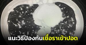 "หมอมนูญ"  แนะคนที่จะเข้าถ้ำหรือโพรงต้นไม้ สวมหน้ากากแบบแพทย์ในห้องผ่าตัด ป้องกันหายใจสปอร์ของเชื้อราเข้าปอด