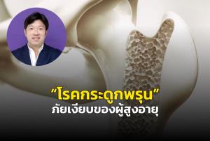 “โรคกระดูกพรุน” ภัยเงียบของผู้สูงอายุ