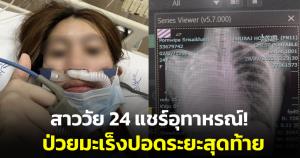 สาววัย 24 แชร์อุทาหรณ์! สูดกลิ่นควันบุหรี่จากคนใกล้ชิด จนป่วยเป็นมะเร็งปอดระยะสุดท้าย