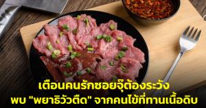 รพ.เวชศาสตร์เขตร้อนเตือนคนรักซอยจุ๊ต้องระวัง พบ "พยาธิวัวตืด" ตัวยาวจากคนไข้ที่กินเนื้อดิบ