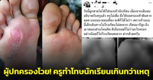 ผู้ปกครองโวย! ลูกเป็นเล็บขบใส่รองเท้าแตะไปเรียน ครูไม่เชื่อสั่งลงโทษถอดรองเท้ายืนตากแดด