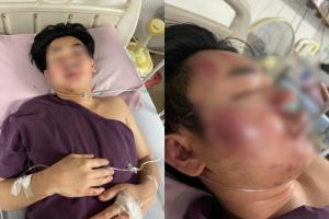 ตร.ยันคดีการ์ดรุมตื้บน้องชาย “เอมมี่ แม็กซิม” ให้ความเป็นธรรมทั้ง 2 ฝ่าย