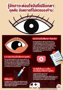 รู้จักภาวะต่อมไขมันที่เปลือกตา อุดตัน อันตรายที่ไม่ควรมองข้าม