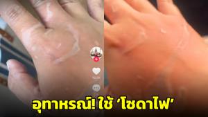 อุทาหรณ์! ใช้ ‘โซดาไฟ’ ทลายท่อตัน พุ่งสวน ถูกมือ-แขน บาดเจ็บพุพอง (ชมคลิป)