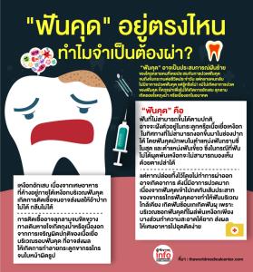 "ฟันคุด" อยู่ตรงไหน  ทำไมจำเป็นต้องผ่า?