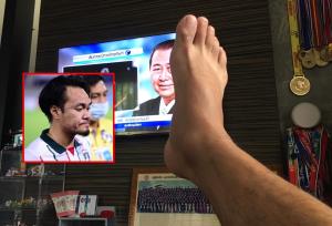 พิชิตพงษ์" อดีตกองกลางทีมชาติไทย โพสต์บ่นปวดเท้า แต่คนโฟกัสจุดอื่น "