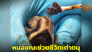 ดร.ธรณ์เศร้า! เผยภาพเต่าตนุที่ถูกช่วยกวาดคราบน้ำมันจากคอ ชี้เป็นตัวที่ 3 แล้ว