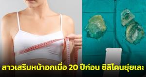 สาวเตือน! เสริมหน้าอกเมื่อ 20 ปีก่อน พอถอดซิลิโคนออกสภาพยุ่ยเละไม่เป็นรูปเดิม