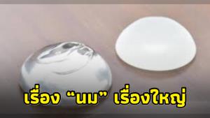 “หมอแล็บฯ” ให้ความรู้ “เสริมหน้าอก” กี่ปีต้องถอดออก