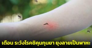 หมอแล็บแพนด้า เตือน ระวังโรคชิคุนกุนยา ยุงลายเป็นพาหะ ระบาดหนักช่วงหน้าฝน