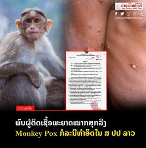 ข่าวการพบผู้ป่วยฝีดาษลิงรายแรกในลาว ที่สื่อมวลชนลาวต่างพากันเผยแพร่ในวันนี้