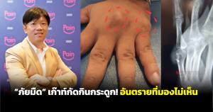 ”ภัยมืด” เกาต์กัดกินกระดูก! อันตรายที่มองไม่เห็น