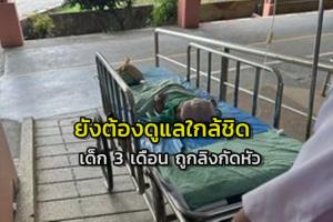 เด็ก 3 เดือนถูกลิงกัดยังต้องเฝ้าติดตามอาการใกล้ชิด พบตอนนี้รู้สึกตัวดี