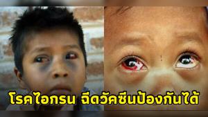 “จ่า” เตือน “โรคไอกรน” รุนแรงถึงเสียชีวิต ป้องกันได้แค่ฉีดวัคซีน