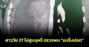 เศร้า! สาววัย 27 ไม่สูบบุหรี่ ตรวจพบ "มะเร็งปอด" "น้องออย" ผู้ป่วยมะเร็งปอดระยะสุดท้าย เตือนมีอาการผิดปกติรีบไปพบแพทย์
