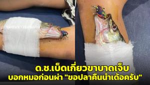 เอ็นดู! ด.ช.11 ขวบ เบ็ดเกี่ยวขาบาดเจ็บ บอกหมอก่อนผ่าตัด "ขอปลาคืนนำเด้อครับ"