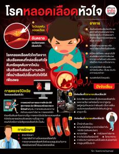 โรคหลอดเลือดหัวใจ