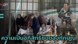 ความเป็นอภิสิทธิชนของทักษิณ