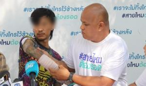 หนุ่มร้องถูกญาติเมายา ใช้มีดฟันเจ็บสาหัส เย็บกว่า 200 เข็ม