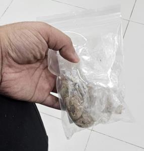 แพทย์ รพ.ดังชุ่ย! ลืมผ้ากอซในช่องคลอด ไอหลุดออกมาเอง ยังไม่มีการขอโทษจากแพทย์ผ่าตัด