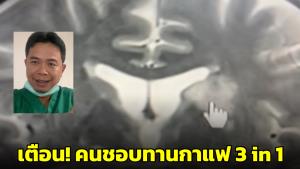 “หมอประชา” เตือน! ทานกาแฟ&amp;#8203;  3&amp;#8203; in&amp;#8203; 1 บ่อยเสี่ยงทำให้เส้นเลือด&amp;#8203;ใน&amp;#8203;สมอง&amp;#8203;ตัน&amp;#8203; (ชมคลิป)