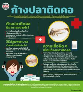 ก้างปลาติดคอ