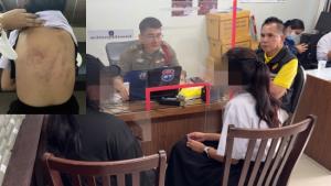 รับน้องโหดผ่านไป 1 ปี มหาลัยดังแก้ไม่ได้ ล่าสุดซ้ำรอยนศ.สาวโร่แจ้งความ รุ่นพี่รุมซ้อมช้ำทั้งตัว ตามขู่ทำร้ายร่างกาย