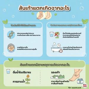 ส้นเท้าแตกเกิดจากอะไร