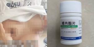หนุ่ม 17 สุดกลุ้ม! หน้าอกโตเกินชาย หลังซื้อยารักษาสิวมากินเอง