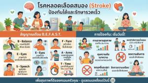 คู่มือชะลอวัยหลอดเลือด: มัดรวมเคล็ดลับป้องกัน ‘สโตรก’ (Stroke) ครบจบในที่เดียว