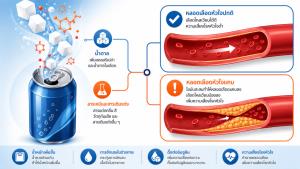 เตือนแล้วนะ! ดื่มน้ำอัดลมมากเกินไป เสี่ยงเส้นเลือดหัวใจตีบ ไขมันอุดตัน
