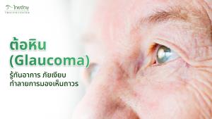 ต้อหิน (Glaucoma) รู้ทันอาการ ภัยเงียบทำลายการมองเห็นถาวร
