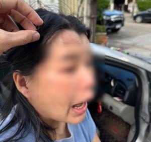สาววัย 38 ร้องสื่อ! ถูกทนายหนุ่มโหดใช้ขวดน้ำปลาฟาด บีบคอ-รัวหมัดใส่ ต่อหน้าลูก 5 ขวบ จนจมูกหัก กระเทือนสมอง