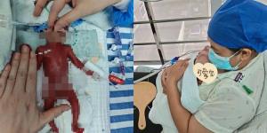 ตัวเท่าฝ่ามือ! แม่จีนคลอดลูกชายก่อนกำหนด หนักเพียง 330 กรัม ลุ้น 105 วัน น้ำหนักพุ่ง 2.5 กก.จนได้กลับบ้าน