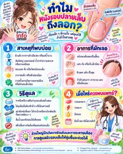 ทำไมหนังรอบปลายเล็บถึงลอก?