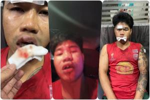 เปิดคลิปวงจรปิดล่า 